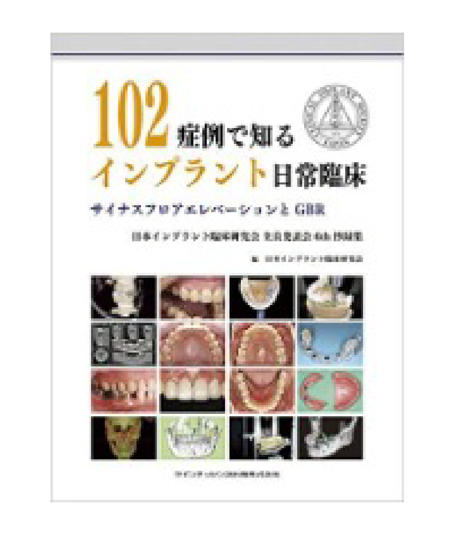 「102症例で知るインプラント日常臨床」