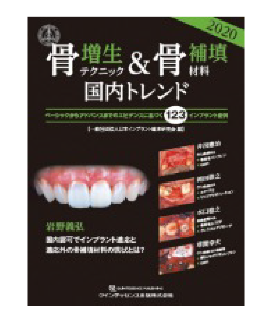 「インパクトの高いインプラント100論文&80症例世界の最新64種類メンブレン情報付き」