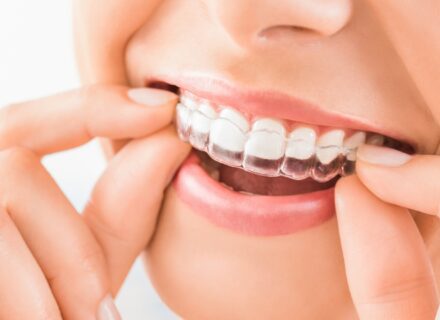 「矯正は高い」──その先にある本当の価値